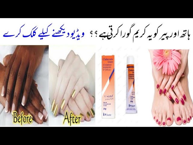Hand and Foot Whitening Formula Cream |Clobevate Review | Amazing Whitening  Cream دیدئو dideo