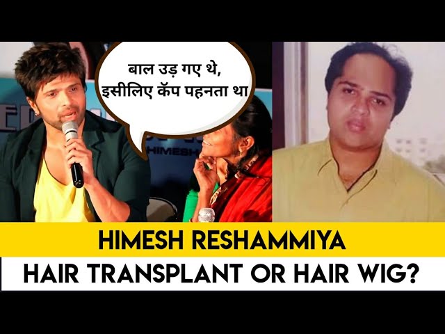 Himesh Reshammiya Baldness story | Angry reaction while replying to media | Hair  Transplant or Hair دیدئو dideo